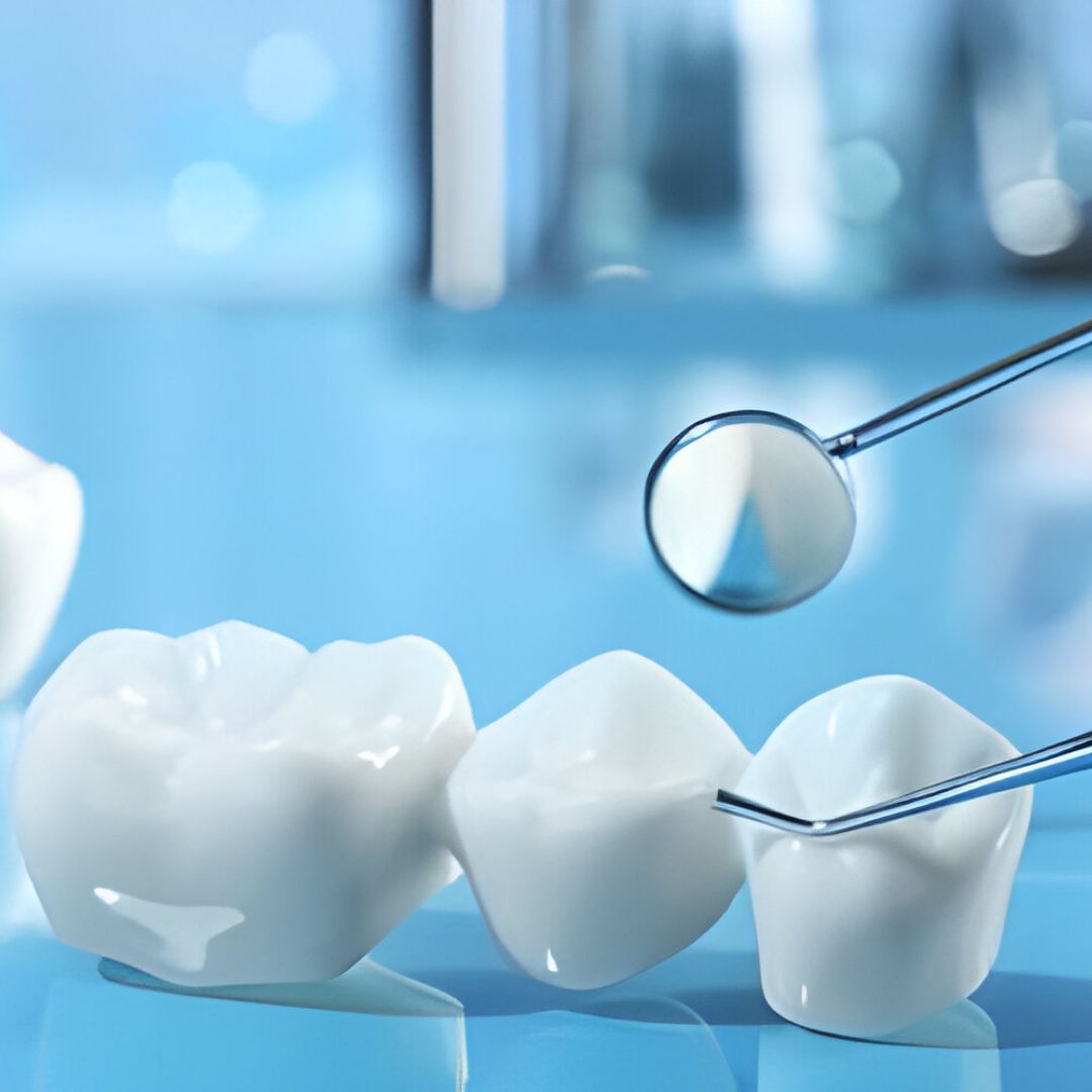 Dental Bridges in Grande Prairie