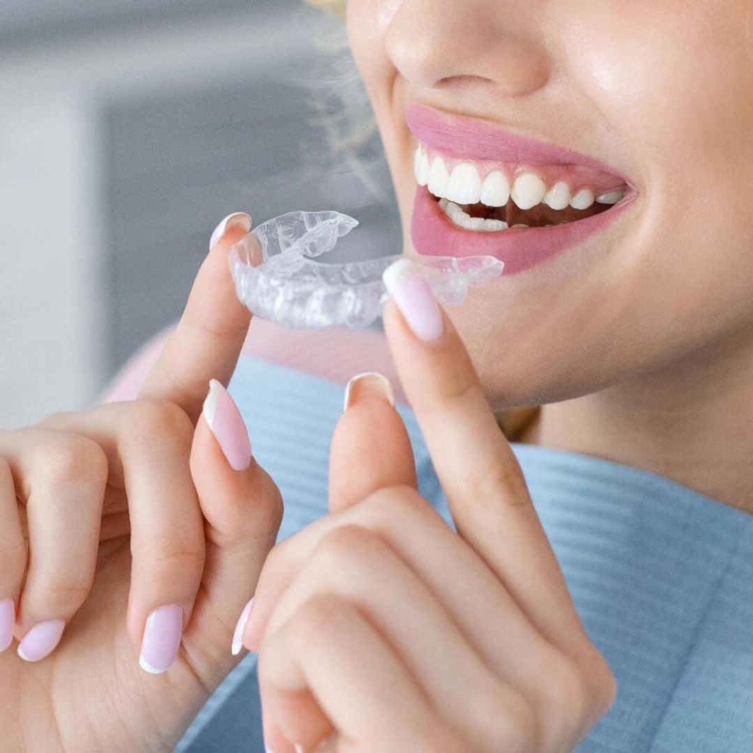 How Invisalign Works